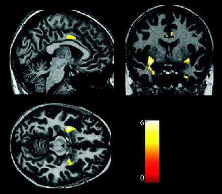 Fig 2.