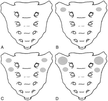 Fig 1.
