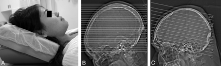 Fig 2.