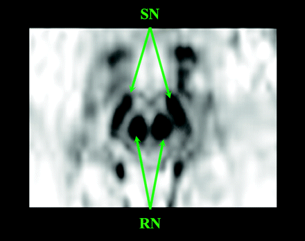 Fig 1.