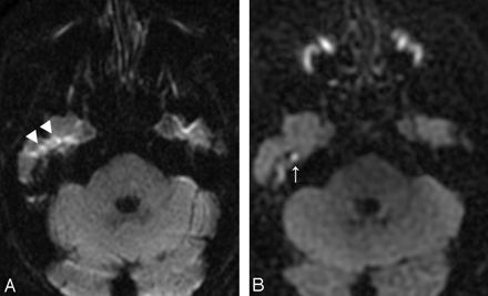 Fig 3.