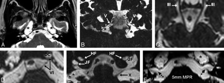 Fig 1.