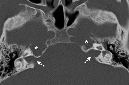 Fig 2.