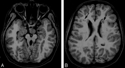 Fig 1.