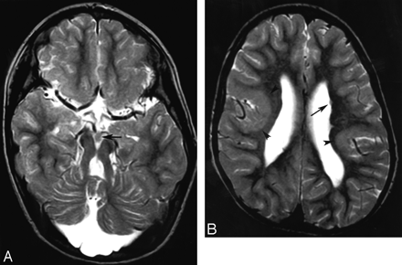 Fig 2.