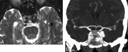 Fig 17.