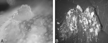 Fig 3.