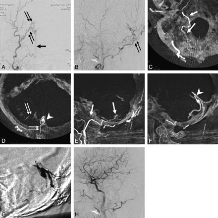 Fig 3.
