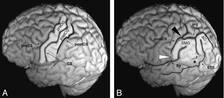 Fig 1.