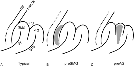 Fig 2.