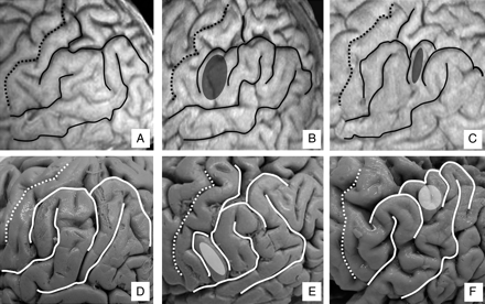 Fig 3.