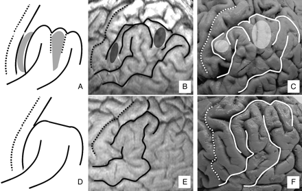 Fig 4.
