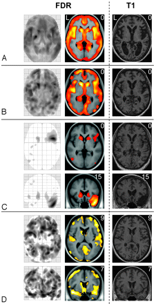 Fig 2.