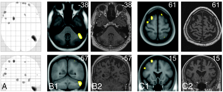 Fig 3.