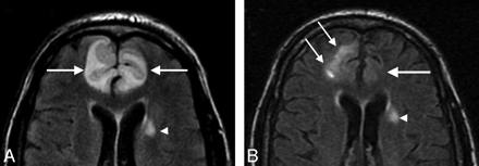 Fig 1.