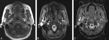 Fig 2.