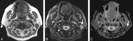 Fig 3.