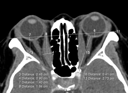Fig 2.