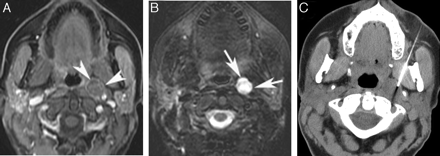 Fig 3.