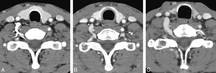Fig 2.