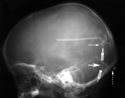 Fig 1.