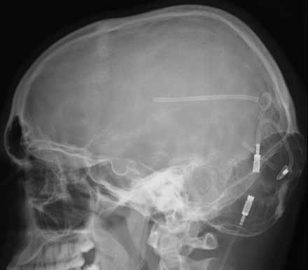 Fig 2.