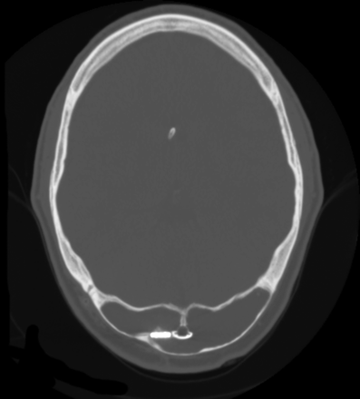 Fig 3.