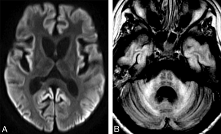   Fig 1. 