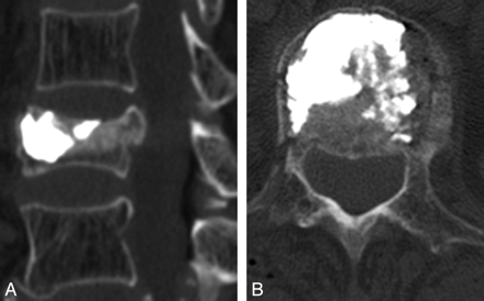 Fig 2.