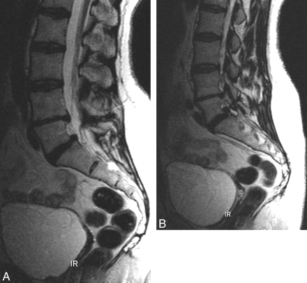 Fig 2.