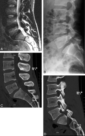 Fig 3.