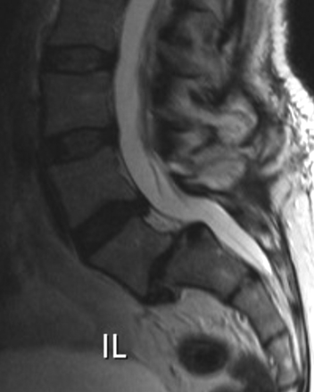 Fig 5.