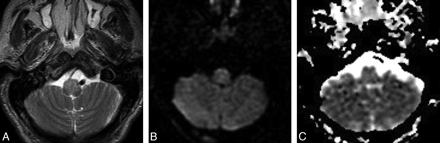 Fig 2.