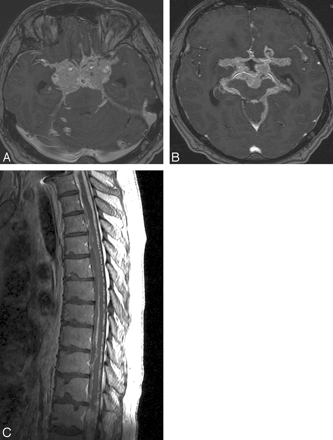   Fig 1. 