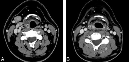 Fig 1.