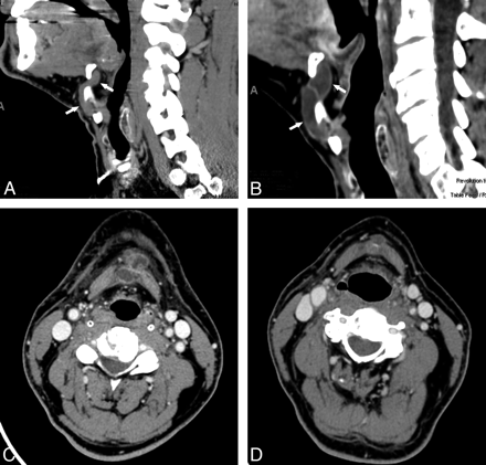 Fig 2.