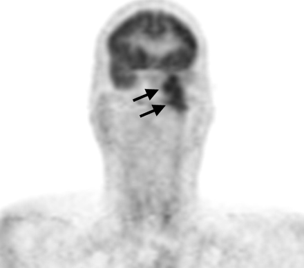 Fig 2.