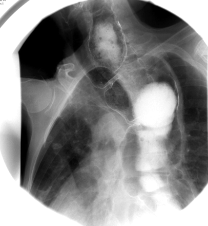 Fig 1.