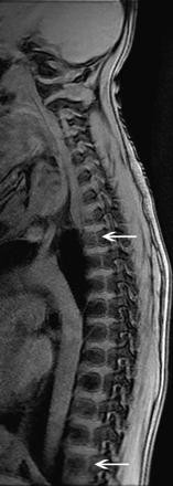 Fig 3.