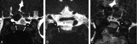 Fig 1.