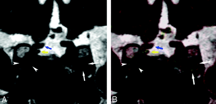 Fig 2.