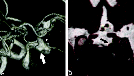 Fig 4.