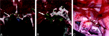 Fig 6.