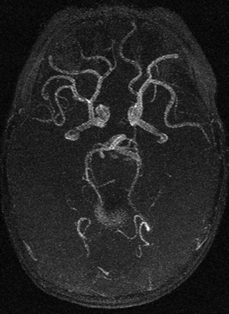 Fig 1.
