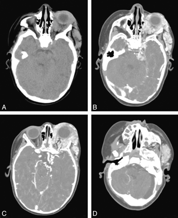 Fig 4.