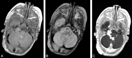 Fig 5.
