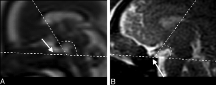 Fig 2.