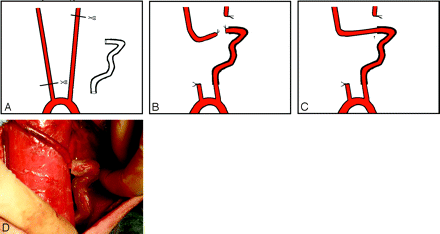 Fig 2.