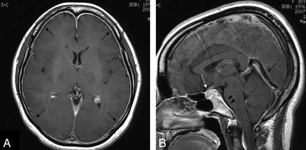 Fig 1.