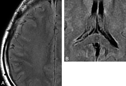 Fig 2.